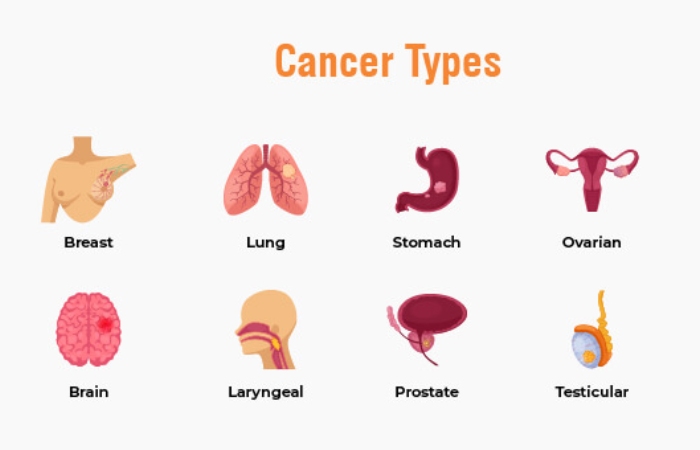 Types of Cancer of Obaroitownintown.com Cancer